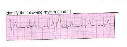 Identify the following rhythm (lead II): ____________________