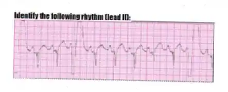 Identify the following rhythm (lead II): ____________________