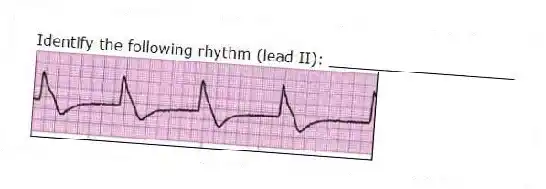 Identify the following rhythm (lead II): ____________________