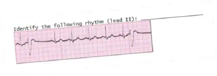 Identify the following rhythm (lead II): ____________________