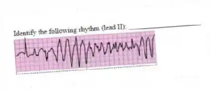 Identify the following rhythm (lead II): ____________________
 