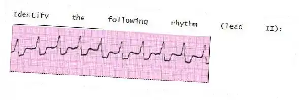 Identify the following rhythm (lead II): ____________________