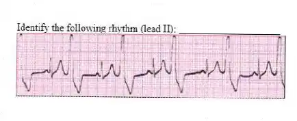 Identify the following rhythm (lead II): ____________________