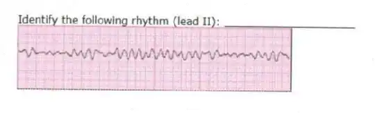 Identify the following rhythm (lead II): ____________________