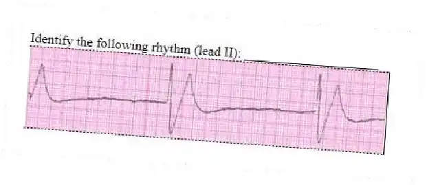 Identify the following rhythm (lead II): ____________________