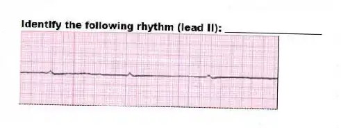 Identify the following rhythm (lead II): ____________________