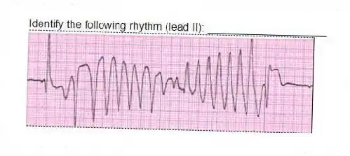 Identify the following rhythm (lead II): ____________________