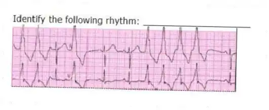 Identify the following rhythm: ____________________
 