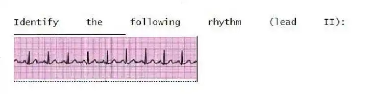 Identify the following rhythm (lead II): ____________________
