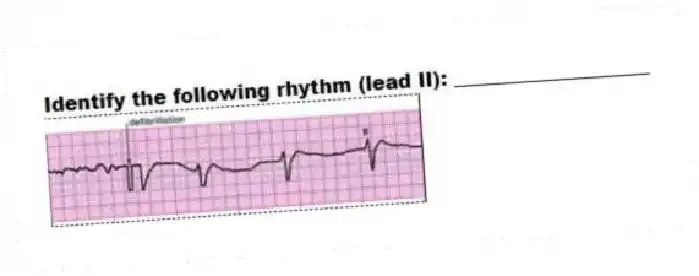 Identify the following rhythm (lead II): ____________________