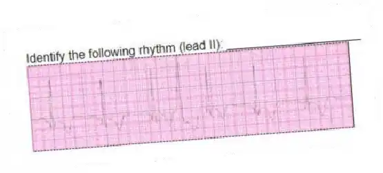 Identify the following rhythm (lead II): ____________________