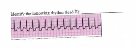 Identify the following rhythm (lead II): ____________________