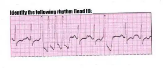 Identify the following rhythm (lead II): ____________________