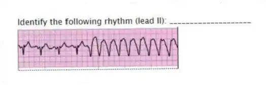 Identify the following rhythm (lead II): ____________________