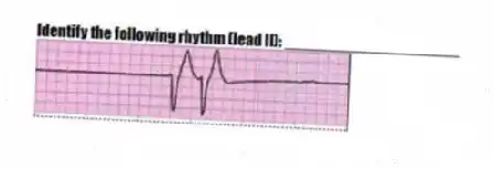 Identify the following rhythm (lead II): ____________________