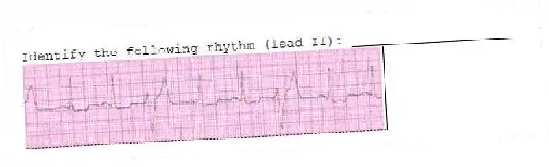 Identify the following rhythm (lead II): ____________________