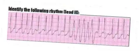 Identify the following rhythm (lead II): ____________________
