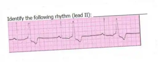 Identify the following rhythm (lead II): ____________________
