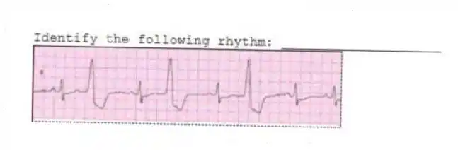 Identify the following rhythm: ____________________