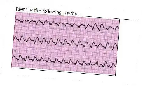 Identify the following rhythm: ____________________