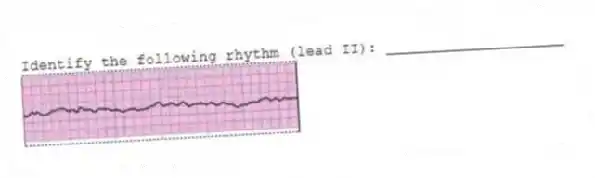 Identify the following rhythm (lead II): ____________________