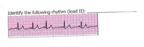Identify the following rhythm (lead II): ____________________