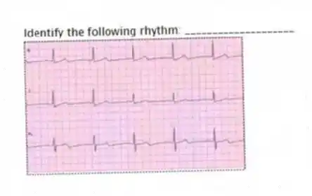 Identify the following rhythm: ____________________