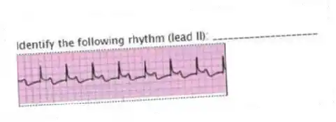 Identify the following rhythm (lead II): ____________________