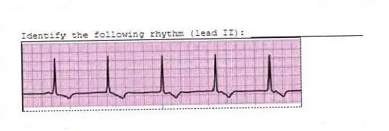 Identify the following rhythm (lead II): ____________________
