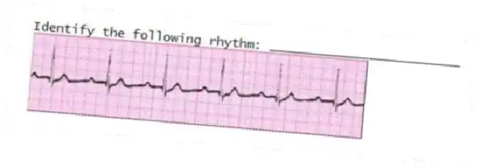 Identify the following rhythm: _________________________
 