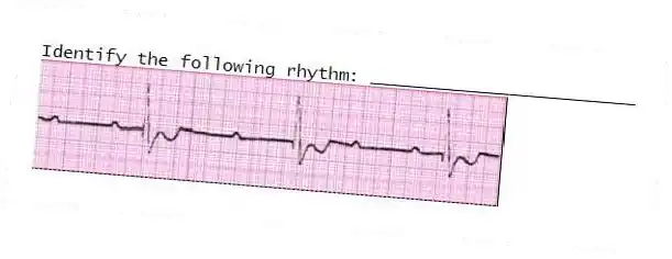 Identify the following rhythm: _________________________