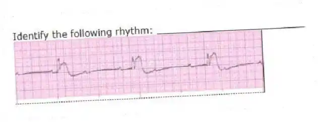 Identify the following rhythm: _________________________