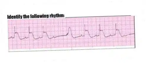 Identify the following rhythm: _________________________