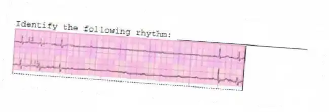 Identify the following rhythm: _________________________
 