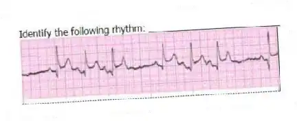Identify the following rhythm: _________________________