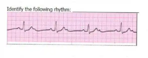 Identify the following rhythm: _________________________
 