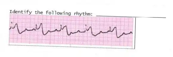 Identify the following rhythm: _________________________