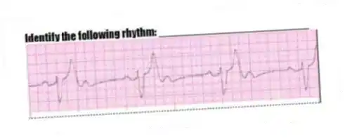 Identify the following rhythm: _________________________