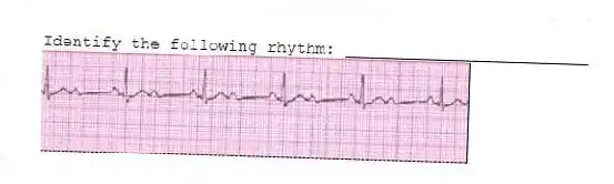 Identify the following rhythm: _________________________