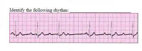 Identify the following rhythm: _________________________