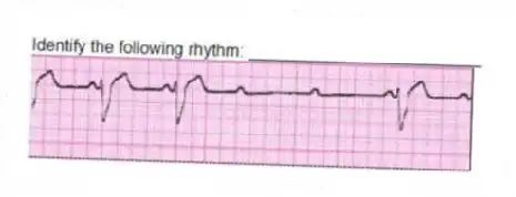 Identify the following rhythm: _________________________
 