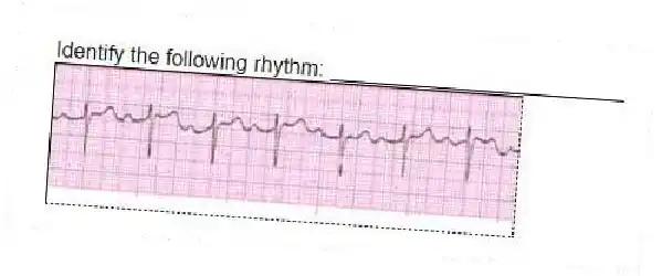 Identify the following rhythm: _________________________