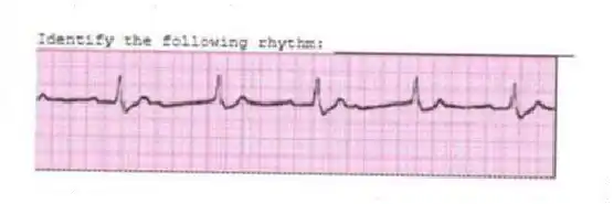 Identify the following rhythm: _________________________