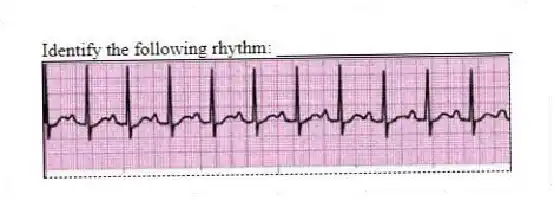 Identify the following rhythm: _________________________