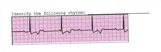 Identify the following rhythm: _________________________