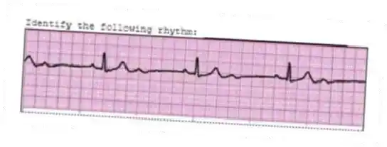 Identify the following rhythm: _________________________