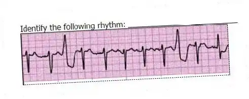 Identify the following rhythm: _________________________