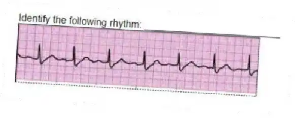 Identify the following rhythm: _________________________