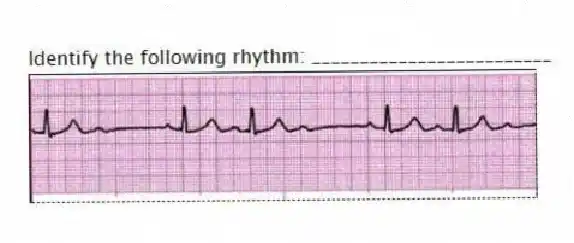 Identify the following rhythm: _________________________