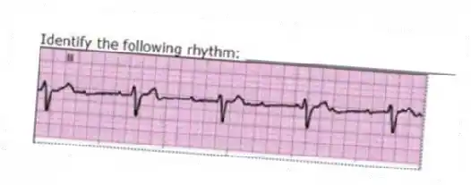 Identify the following rhythm: _________________________